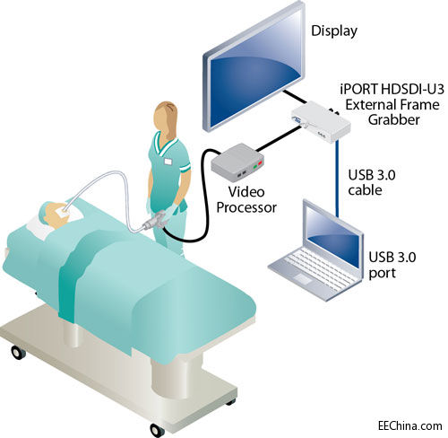 iPORTHDSDI-Endoscope.jpg