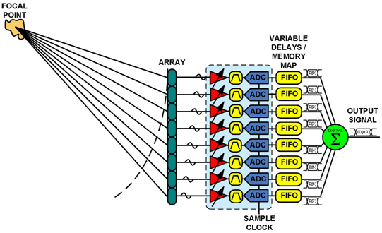 Ultrasound_Partitioning_03.gif